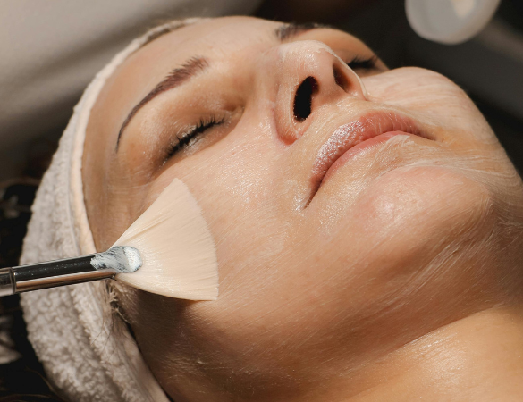 Chemical Peels Pontefract skin clinic